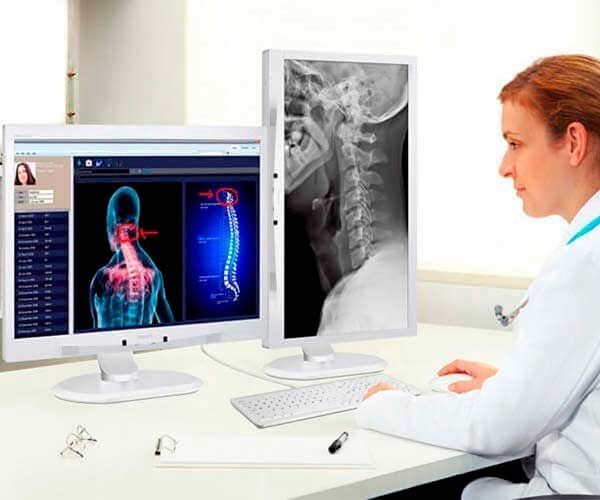 Monitor Philips 24 Pol. LCD IPS Clinical Review Display Branco, C240P4QPYEW