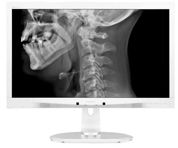 Monitor Philips 24 Pol. LCD IPS Clinical Review Display Branco, C240P4QPYEW