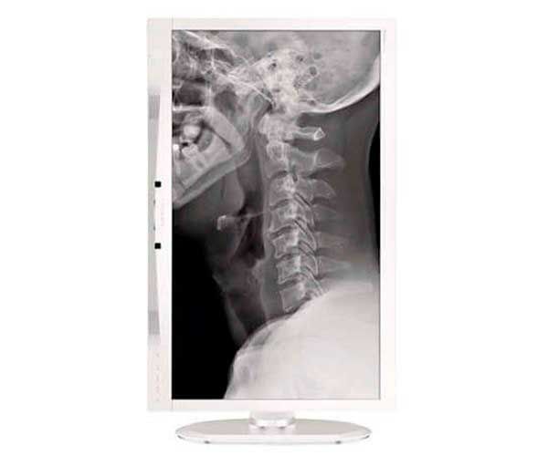 Monitor Philips 24 Pol. LCD IPS Clinical Review Display Branco, C240P4QPYEW