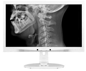 Monitor Philips 24 Pol. LCD IPS Clinical Review Display Branco, C240P4QPYEW